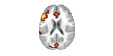 Easy fMRI reporting logo